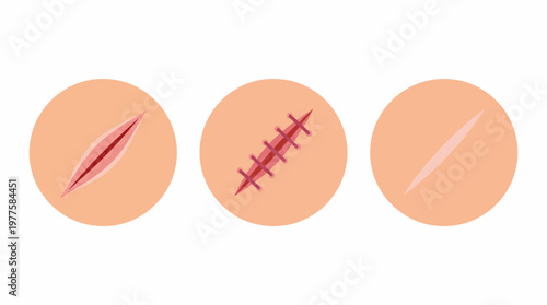 This image features three circular designs depicting different types of skin cuts and stitches, showcasing medical and artistic interpretations of skin health.
