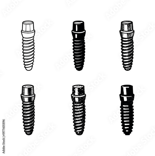 Dental Implant Variations. Titanium dental implant screw with threaded body and abutment top, used to replace missing tooth roots