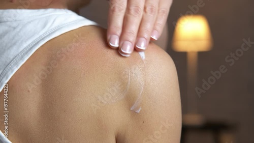 Woman applying ointment on sunburned red skin. Young woman with beautiful french manicure gently applying a soothing moisturizing cream to her sunburnt shoulder, rubbing the relieving lotion