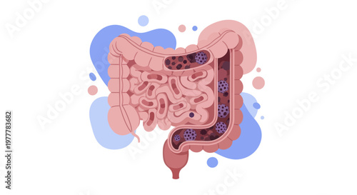 Detailed illustration of the human digestive system showing intestines and colon.