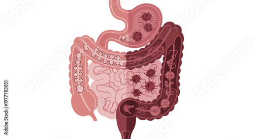 Illustration of Human Digestive System with Viral Infection.