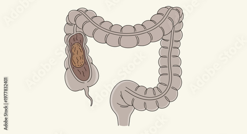 Human Appendix Anatomy.