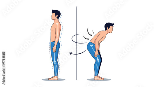 Comparative illustration showing correct and incorrect standing posture with anatomical highlights of the spine.