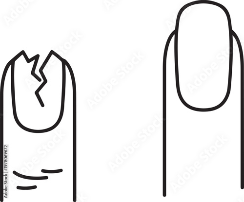 Broken fingernail versus healthy long nail comparison illustrating manicure problems and nail health care concept