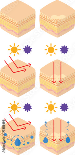 Examples of moisture and skin barriers due to external irritation, effects.