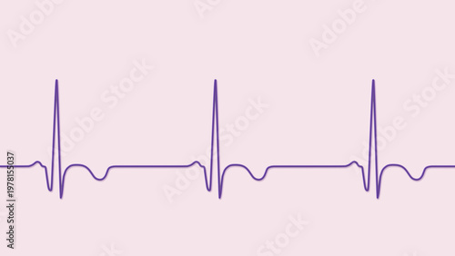 Photos Subacute stage of myocardial infarction, 3D