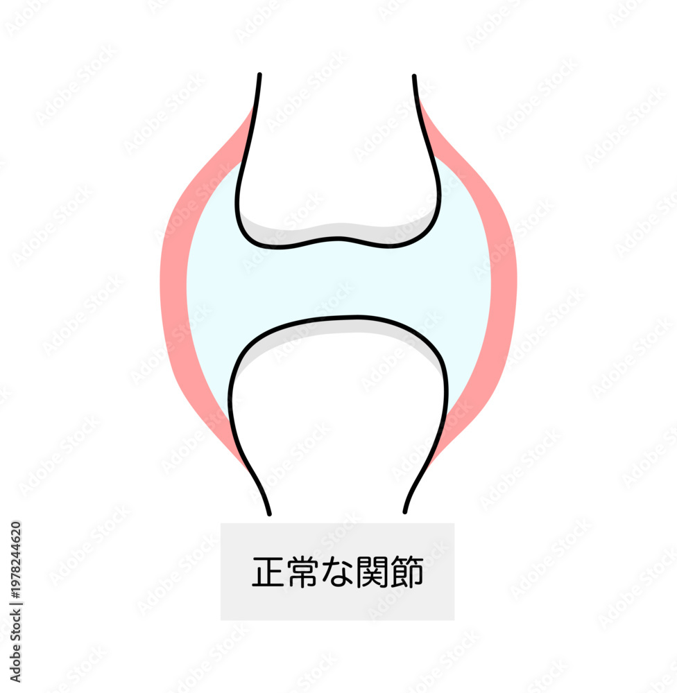 Obraz premium 痛風における正常な関節のイラスト