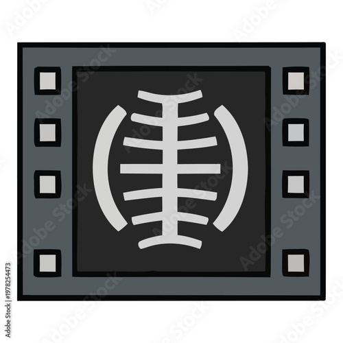 Medical X-ray Image of Ribs and Thorax on a Screen