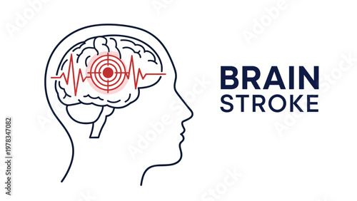 Medical illustration of a human head and brain with a target and pulse line to explain the concept and symptoms of a brain stroke.