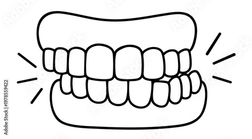 Bruxism teeth grinding and clenching condition, excessive pressure causing enamel wear and dental damage