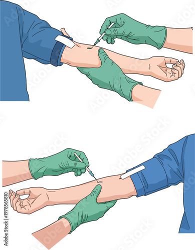 Medical Healthcare Professional Drawing Blood Sample from Patient Arm with Needle and Syringe for Laboratory Testing and Blood Donation