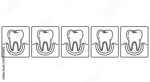 A series of five identical tooth illustrations within individual square frames showing dental structure