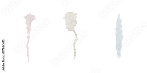 фотографія A microscopic view of three sperm cells against a black background
