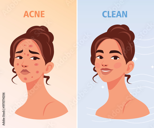 Vector illustration, damaged skin and healthy skin. Portrait woman has skin problems, acne, age spots, irritations, other has a smooth, radiant complexion. For care products, beauty blogs