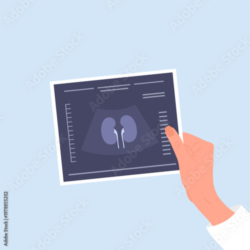 Kidney health. Female hand holding kidneys ultrasound result. Medical diagnosis and treatment for cysts, pyelonephritis or renal cancer. Vector illustration in flat cartoon style.