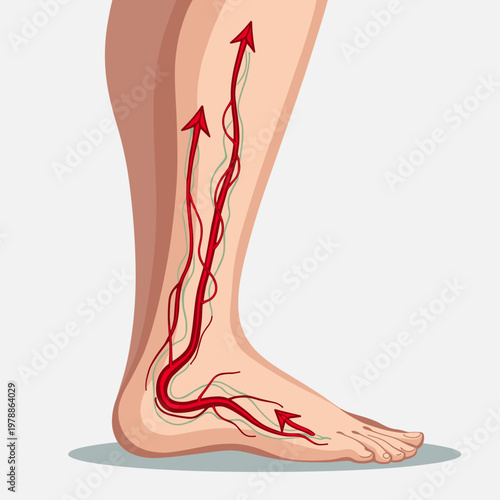 A medical diagram showing red arterial flow and green veins in a human leg and foot. The anatomical illustration features red arrows indicating blood circulation direction against a neutral background