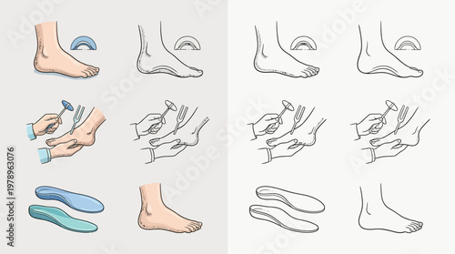 Illustrations showing the anatomy of the human foot, arch support, and custom orthotics for foot care and comfort.