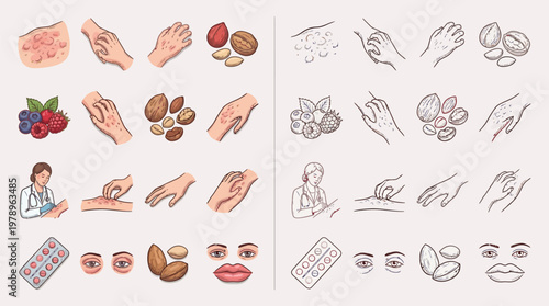 Allergy symptoms and causes illustrated with icons: skin rash, hands, nuts, berries, doctor, medication, eyes, and lips.