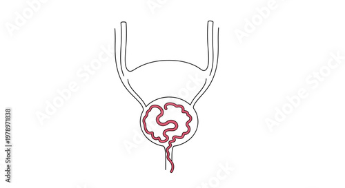 Illustration of the human urinary bladder with a red, worm-like structure inside, representing a medical condition or internal organ detail