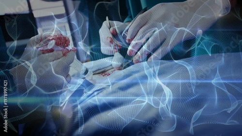 Two surgeons applying cautery at incision, repeating action to cauterize while blue mesh overlaying