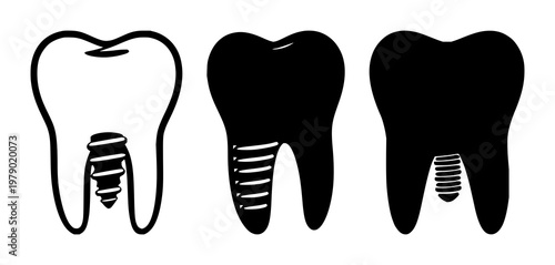 Dental implant tooth icon set with solid black shape on white background featuring dental implant, tooth, icon with vector and minimalist design