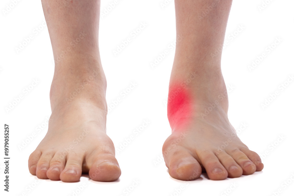 Fototapeta premium Close-up of bare adult feet showing flat-footed arch and ankle on a white background, useful for foot health, podiatry, or orthopedic contexts.