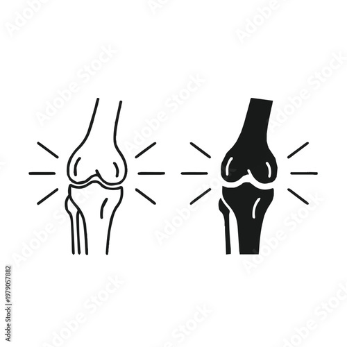 Healthy knee joint compared to inflamed arthritic knee