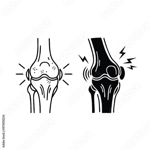 Healthy knee joint compared to an arthritic knee joint