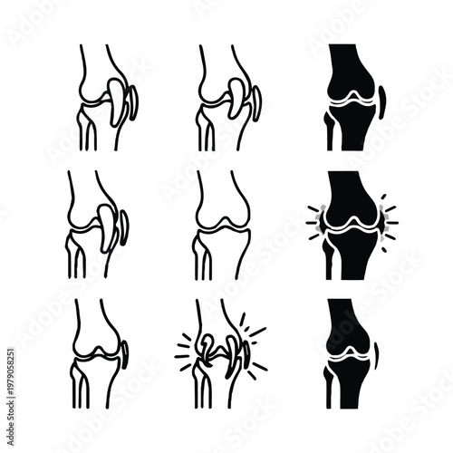Illustrations of various knee conditions and injuries