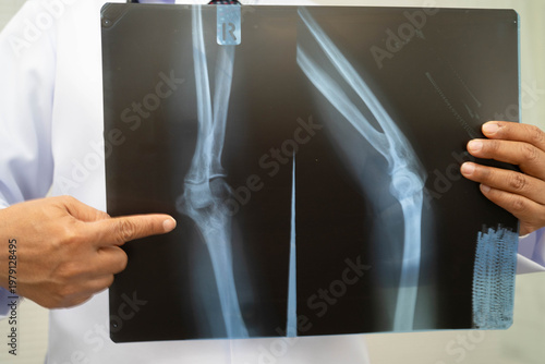 Принти на полотні Doctor examining knee joint bone radiography xray film.