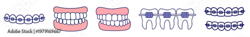 Orthodontic Braces and Bite Alignment Set, Dental Bracket System on Teeth, Correct and Incorrect Occlusion, Tooth Straightening Process and Jaw Alignment