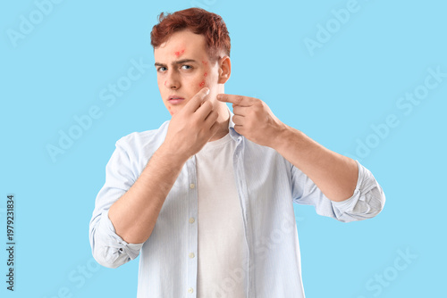 Teenage boy with acne squis...