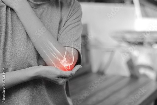 Bilde på lerret Monochrome photo of woman suffering from severe elbow pain, holding her arm with a red glowing anatomical bone graphic overlay showing joint inflammation, arthritis, or injury in medical concept