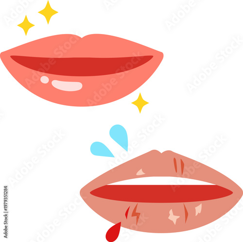 健康的な唇と荒れた唇