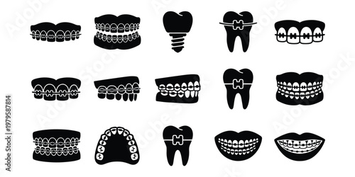 Dental Braces and Orthodontic Treatment Icons, Set of 15 Black Silhouette Vector Elements, Teeth Alignment and Dental Implant Symbols