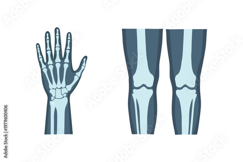 Xray of human hand and knees, medical diagnostic imaging of bones