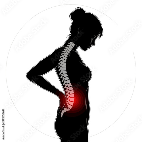 Woman with Lower Back Pain, Spine Highlighted in Red