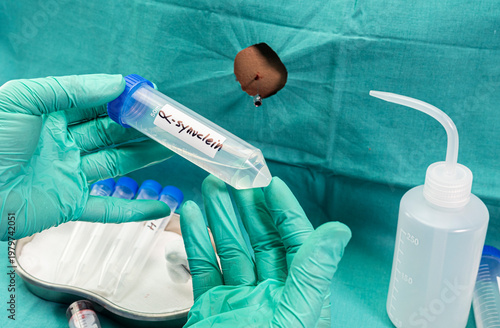 Biomarkers in Cerebrospinal Fluid Discriminate Between Dementias, Combining biomarkers from cerebrospinal fluid is helping researchers identify 