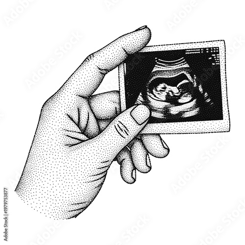 Hand Holding Ultrasound Fetal Scan Photo in Retro Stipple Halftone Style Illustration
