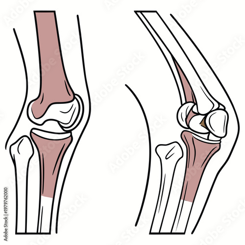 Comparison diagram of human knee joint bone structures in different positions