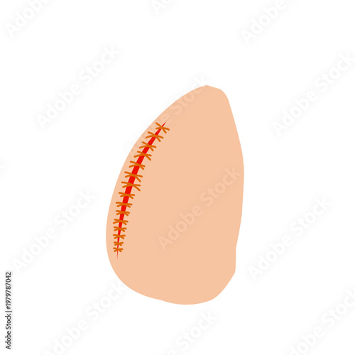 Vector illustration of a wound stitch. Flat design of a stitched wound. Illustration of a wound stitch on the skin