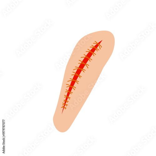Vector illustration of a wound stitch. Flat design of a stitched wound. Illustration of a wound stitch on the skin