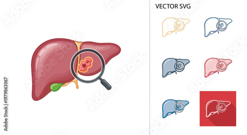 Human liver anatomy with magnifying glass showing tumor, medical illustration
