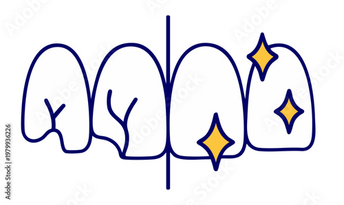 Teeth Whitening Before and After Comparison, Stained and Clean Bright Enamel Smile