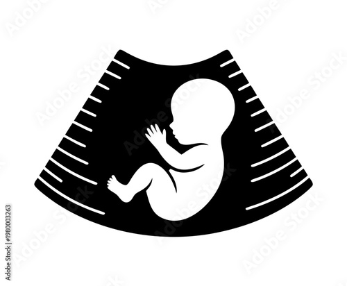 Pregnancy Ultrasound Vector Icon, Baby Sonogram Silhouette Illustration