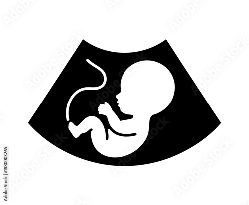 Pregnancy Ultrasound Vector Icon, Baby Sonogram Silhouette Illustration