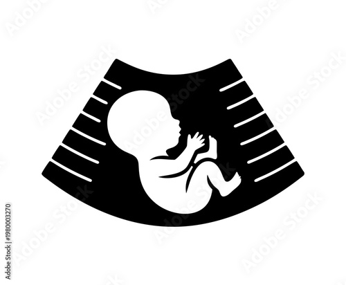 Pregnancy Ultrasound Vector Icon, Baby Sonogram Silhouette Illustration