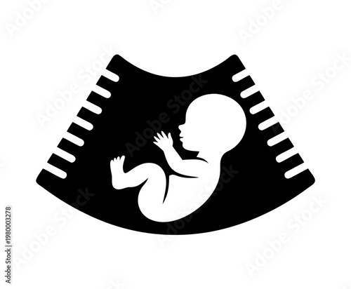 Pregnancy Ultrasound Vector Icon, Baby Sonogram Silhouette Illustration