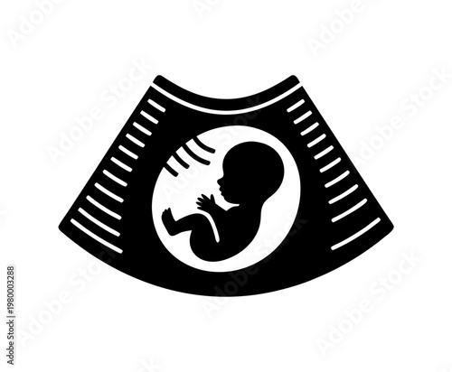 Pregnancy Ultrasound Vector Icon, Baby Sonogram Silhouette Illustration