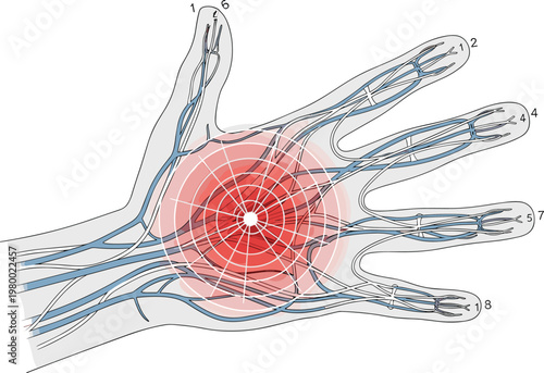 Medical anatomical vector illustration of human hand showing nerve pain carpal tunnel syndrome inflammation and palm injury with red glowing circular ache signal
